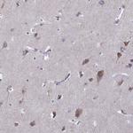 VGF Antibody in Immunohistochemistry (IHC)