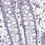 VGF Antibody in Immunohistochemistry (IHC)