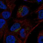 VGF Antibody in Immunocytochemistry (ICC/IF)