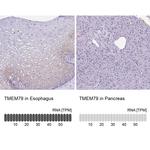 TMEM79 Antibody in Immunohistochemistry (IHC)