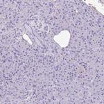 TMEM79 Antibody in Immunohistochemistry (IHC)