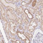 ITPK1 Antibody in Immunohistochemistry (Paraffin) (IHC (P))