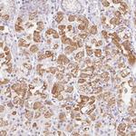 ITPK1 Antibody in Immunohistochemistry (Paraffin) (IHC (P))