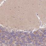 ITPK1 Antibody in Immunohistochemistry (IHC)