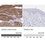 Calsequestrin 2 Antibody in Immunohistochemistry (IHC)