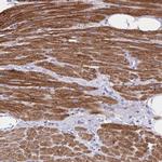 Calsequestrin 2 Antibody in Immunohistochemistry (IHC)