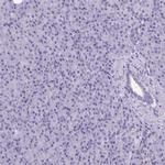 ATP6V0D2 Antibody in Immunohistochemistry (Paraffin) (IHC (P))