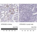 ATP6V0D2 Antibody in Immunohistochemistry (IHC)