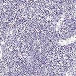 ATP6V0D2 Antibody in Immunohistochemistry (IHC)