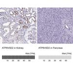 ATP6V0D2 Antibody