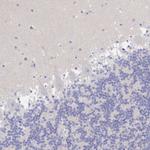 ZNF561 Antibody in Immunohistochemistry (Paraffin) (IHC (P))