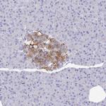 ZNF561 Antibody in Immunohistochemistry (Paraffin) (IHC (P))