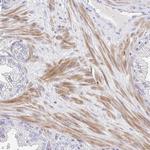 ZNF561 Antibody in Immunohistochemistry (Paraffin) (IHC (P))