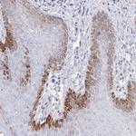 ZNF561 Antibody in Immunohistochemistry (Paraffin) (IHC (P))