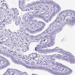 UPP1 Antibody in Immunohistochemistry (Paraffin) (IHC (P))