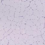 UPP1 Antibody in Immunohistochemistry (Paraffin) (IHC (P))