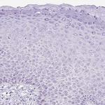 UPP1 Antibody in Immunohistochemistry (Paraffin) (IHC (P))