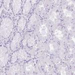 UPP1 Antibody in Immunohistochemistry (IHC)