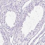 HEXB Antibody in Immunohistochemistry (Paraffin) (IHC (P))