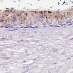 HEXB Antibody in Immunohistochemistry (IHC)