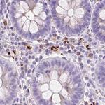 HEXB Antibody in Immunohistochemistry (IHC)