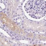 HEXB Antibody in Immunohistochemistry (IHC)