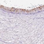 HEXB Antibody in Immunohistochemistry (IHC)