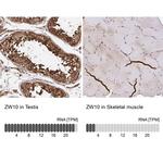 ZW10 Antibody in Immunohistochemistry (IHC)