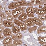 ZNF101 Antibody in Immunohistochemistry (Paraffin) (IHC (P))