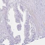 ZNF101 Antibody in Immunohistochemistry (Paraffin) (IHC (P))