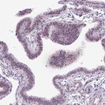 RRS1 Antibody in Immunohistochemistry (IHC)