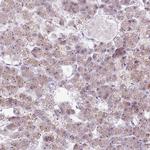 RRS1 Antibody in Immunohistochemistry (IHC)