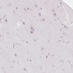 RRS1 Antibody in Immunohistochemistry (IHC)