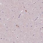 NOS1AP Antibody in Immunohistochemistry (Paraffin) (IHC (P))