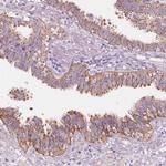 NOS1AP Antibody in Immunohistochemistry (Paraffin) (IHC (P))