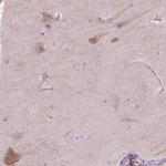 NOS1AP Antibody in Immunohistochemistry (Paraffin) (IHC (P))