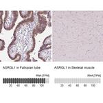 ALP Antibody in Immunohistochemistry (IHC)