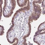 ALP Antibody in Immunohistochemistry (IHC)