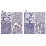 SLC28A2 Antibody in Immunohistochemistry (IHC)