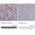 SLC28A2 Antibody