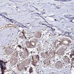 TNMD Antibody in Immunohistochemistry (Paraffin) (IHC (P))