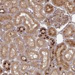 TNMD Antibody in Immunohistochemistry (Paraffin) (IHC (P))