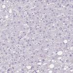 CHST3 Antibody in Immunohistochemistry (IHC)