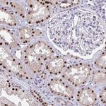 SCLY Antibody in Immunohistochemistry (Paraffin) (IHC (P))