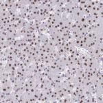 SCLY Antibody in Immunohistochemistry (Paraffin) (IHC (P))