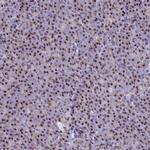 SCLY Antibody in Immunohistochemistry (Paraffin) (IHC (P))