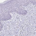 SCLY Antibody in Immunohistochemistry (Paraffin) (IHC (P))