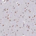 SEMA6B Antibody in Immunohistochemistry (Paraffin) (IHC (P))