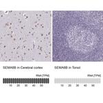 SEMA6B Antibody in Immunohistochemistry (IHC)