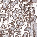 MXRA8 Antibody in Immunohistochemistry (Paraffin) (IHC (P))